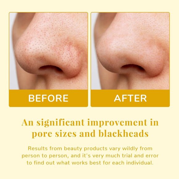 ANAI RUI Pore Minimizing Pads, with Witch Hazel, PHA, Salicylic Acid - 50 Pads - Picture 3 of 5